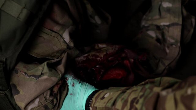 A detailed close-up shot of a military paramedic, wearing tactical gloves and a medical patch, carefully dressing and treating a visible arm wound of a soldier in a camouflage uniform. Real-life field
