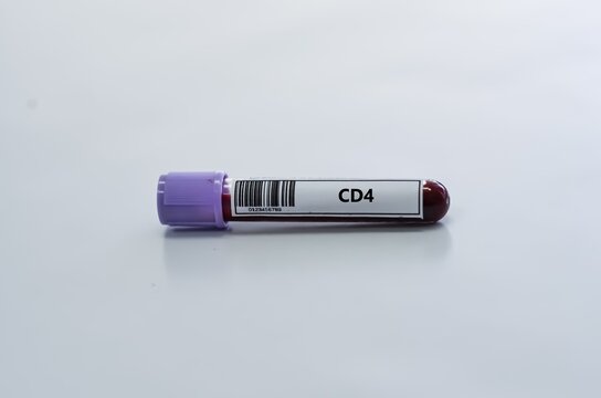 Blood sample tube for CD4 test analysis.