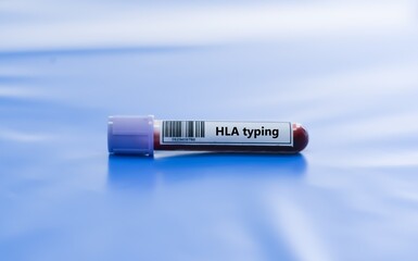 Fototapeta premium Blood sample tube for HLA typing test analysis.