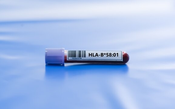 Blood sample tube for HLA-B*58:01 test analysis.