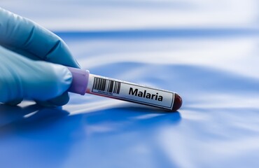 Obraz premium Blood sample tube for malaria test analysis.