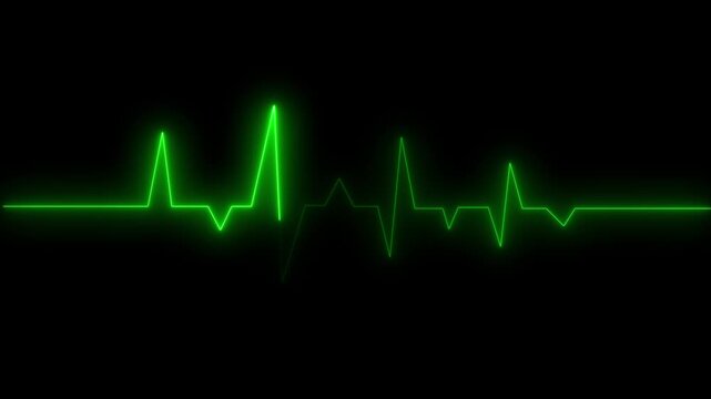 Emergency heartbeat monitor displaying critical cardiac rhythm patterns on a dark background