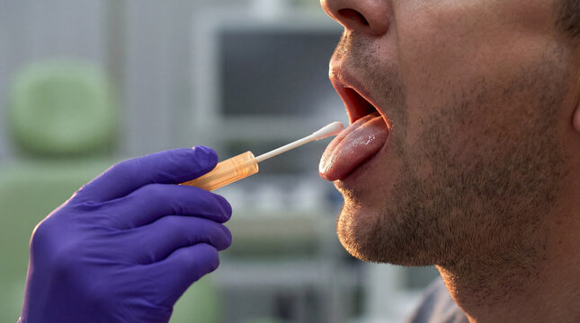 Medical professional taking an oral swab sample from a patient for diagnostic testing. Health and wellness concept