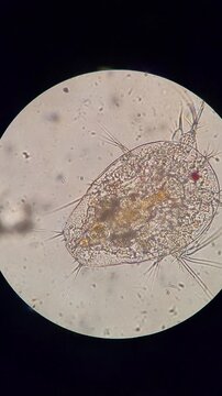 Microscopic view of Nauplius larva