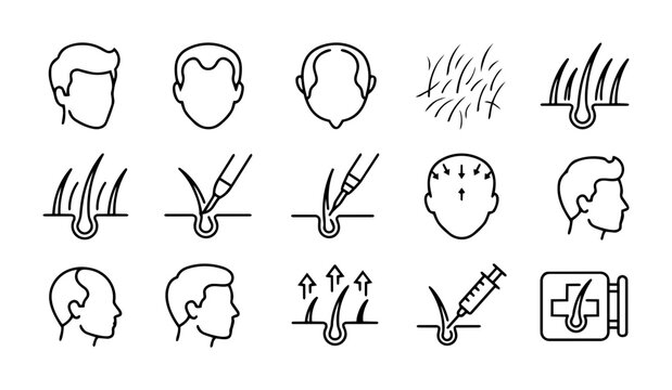 Hair Transplant Procedure Line Icons Set &ndash; Hair Loss, Follicle Extraction, Implantation and Regrowth Outline Collection