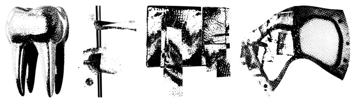 Radiographic dental scan showing tooth roots, enamel, pulp chamber, and jawbone density, used for orthodontic diagnosis, cavity detection, and implant planning.