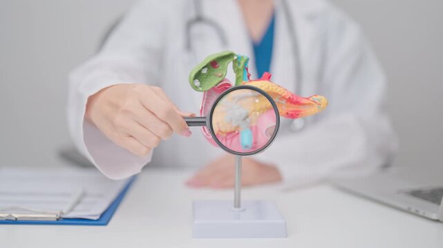 Doctor with human Pancreatitis anatomy model with Pancreas, Gallbladder, Bile Duct, Duodenum, Small intestine. Pancreatic cancer, Acute and Chronic pancreatitis, Digestive system and Health concept