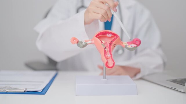 Doctor with Uterus and Ovaries anatomy model. Ovarian and Cervical cancer, Cervix disorder, Endometriosis, Hysterectomy, Uterine fibroids, Reproductive system, Pregnancy and health concept
