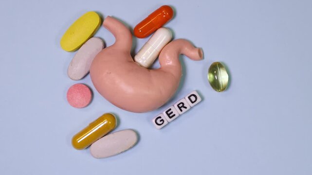 GERD medical concept with stomach model and pills