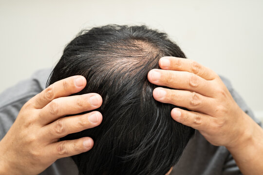 Bald in the middle head and begin no loss hair glabrous of mature Asian business smart active office man.