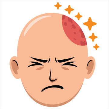 Illustration Of A Mans Head With A Bump And Stars After An Impact Isolated Vector Illustration On White Background