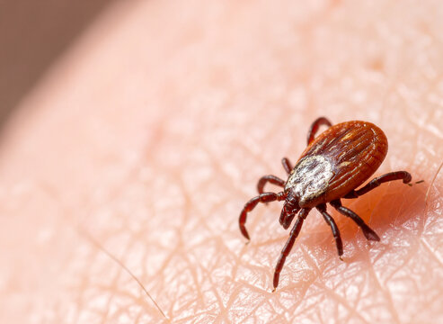 Garrapata sobre piel humana en primer plano macro, parasito peligroso para personas perros y mascotas, transmisor de enfermedades como Lyme, concepto de salud