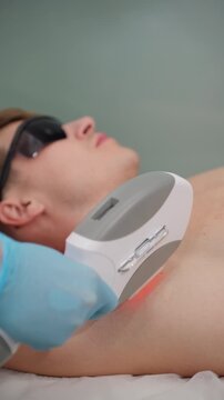 Close-up of beautician hand performing laser hair removal on man armpit, intense pulsed light flash during epilation and depilation treatment.Professional body grooming and skincare treatment man