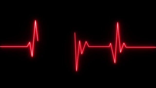 Heart failure, cardiac arrest, wave attenuation chart self drawing animation. Animated red line on black background.