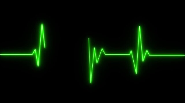 Heart failure, cardiac arrest, wave attenuation chart self drawing animation. Animated red line on black background.