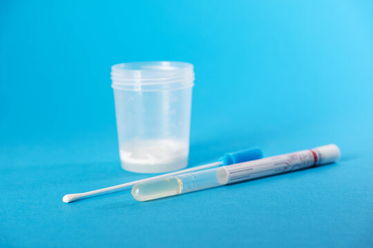 A container with sperm and prostate fluid on a blue background, to detect gardnerella and cytomegalovirus infections. Copy space for text