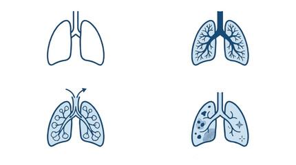 Obraz premium Human Lung Anatomy Icons Set Showing Healthy and Diseased States