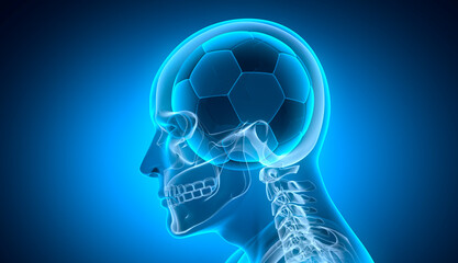 Soccer ball inside human head - medical x ray illustration - symbol of passion for sports