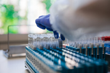Expert Technician Systematically Handling Laboratory Vials In Sterilized Environment For Testing Purposes © flywish