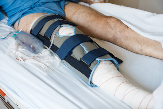 Patient recovering from knee surgery with leg brace and drainage