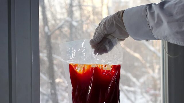 Blood sample analysis in laboratory environment
