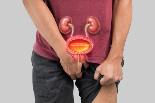 Man with Symptoms of Benign Prostatic Hyperplasia (BPH) or Enlarged Prostate, Experiencing Lower Abdominal Pain and Bladder Discomfort