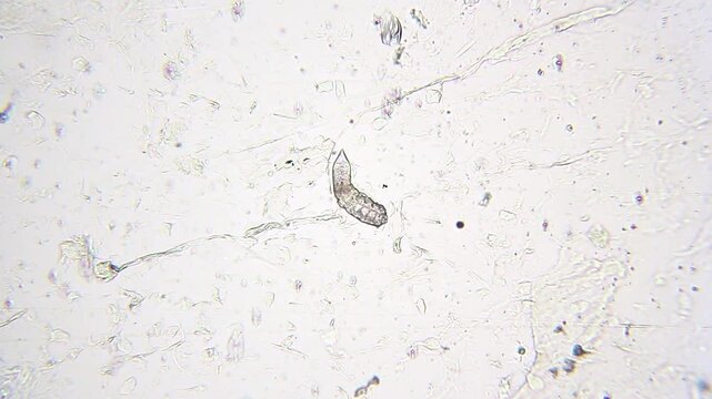 Demodex brevis mite moving legs with visible body structure under 100x bright field microscopy. 4K scientific microscopy footage.