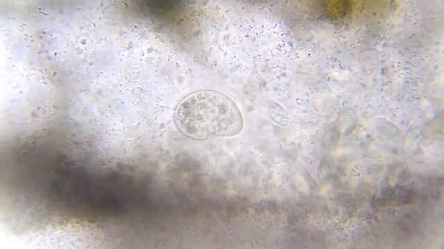 Ciliates surrounded by dense bacterial colony under 100x bright field microscopy. 4K scientific microscopy footage.