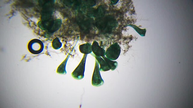 Colony of Stentor ciliates attached to substrate under 40x bright field microscopy. 4K scientific microscopy footage.