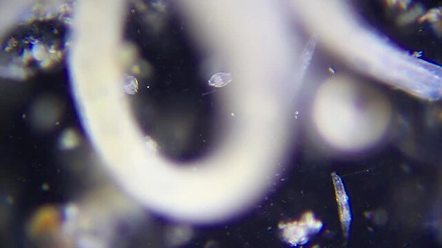 Rotifers in foreground with annelid worms swimming in background under 100x dark field microscopy. 4K scientific microscopy footage.