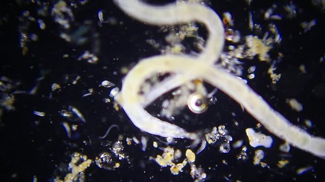 Rotifers in foreground with annelid worms swimming in background under 40x dark field microscopy. 4K scientific microscopy footage.