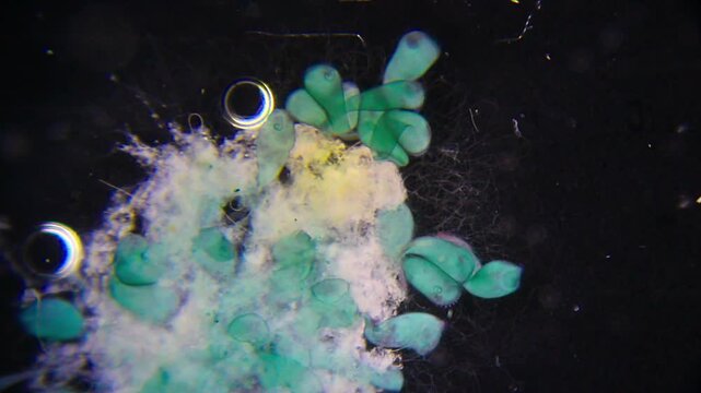 Colony of Stentor ciliates attached to substrate under 40x dark field microscopy. 4K scientific microscopy footage.