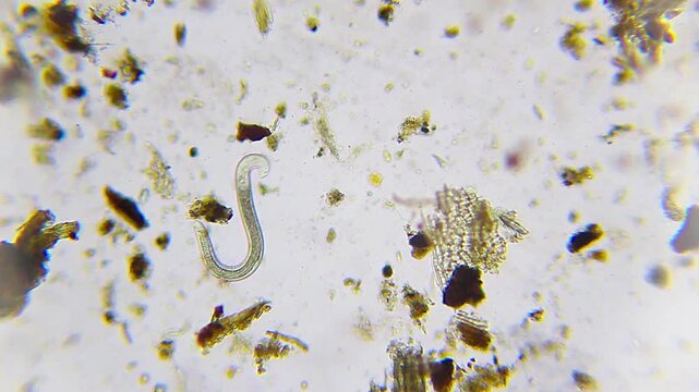 Low motility nematode bending and undulating under 100x bright field microscopy. 4K scientific microscopy footage.