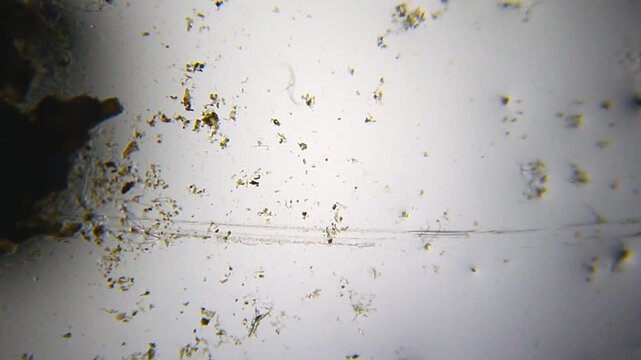 Small nematode rapidly moving and bending in panoramic view under 40x bright field microscopy. 4K scientific microscopy footage.