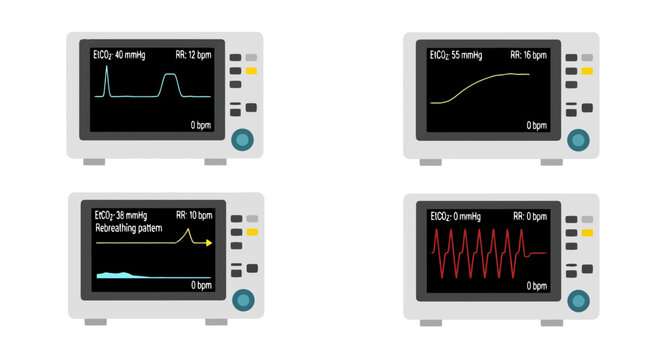 Set of 4 Capnography Medical Monitors Displaying EtCO2 Waveforms and Respiratory Rate for Anesthesia and Patient Vital Signs Monitoring
