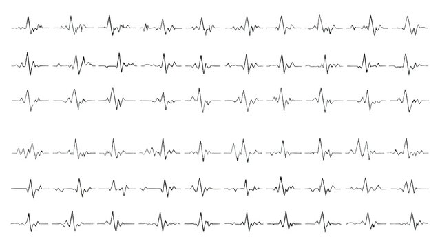 ecg heartbeat pattern on white background