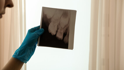 Black and white dental X-ray showing upper teeth and roots. Concept of dentistry, oral health, medical diagnostics, and dental care © leroy