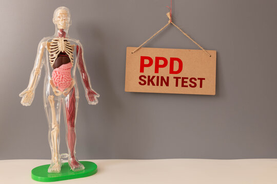 Grey stethoscope and paper plate with a sheet of white paper with text PPD SKIN TEST