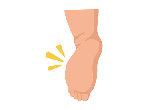 Edema or Swollen Foot Illustration
