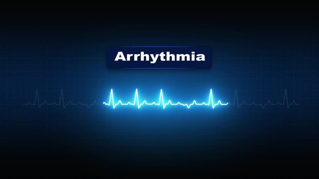 Heart Health Monitor Digital ECG Arrhythmia Animation
