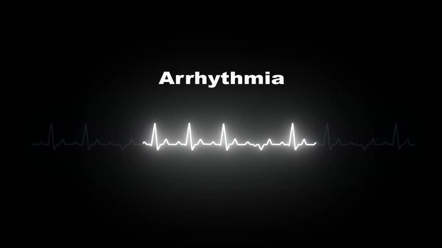 Arrhythmia Pulse Alpha Channel ECG Heart Rate Animation