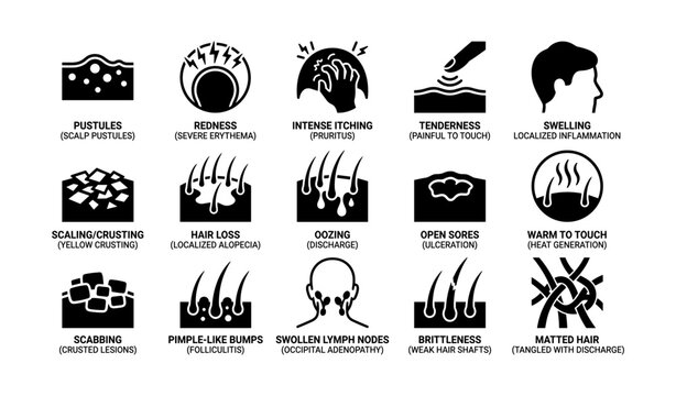 Scalp conditions: symptoms and signs illustrated