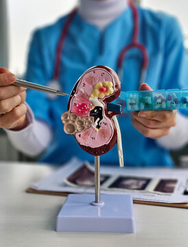 A medical professional holds a model of a kidney while explaining its structure and functions