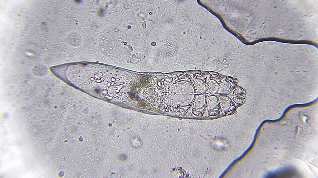 Demodex brevis mite immobile with visible internal structure under 400x bright field microscopy. 4K scientific microscopy footage.