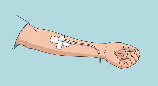 Arm with IV drip, medical intervention
