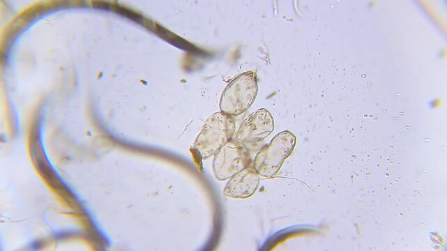 Nematodes moving near banana starch particles under 100x bright field microscopy. 4K scientific microscopy footage.