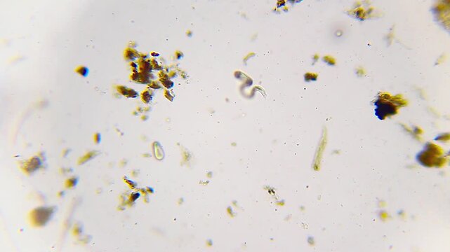 Two nematodes of different sizes moving in the same field under 100x bright field microscopy. 4K scientific microscopy footage.