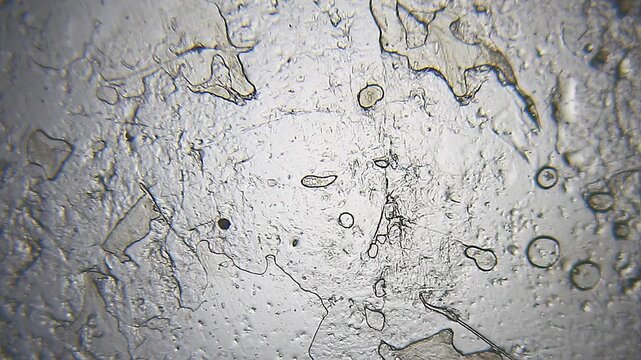 Demodex brevis mite moving legs under 40x bright field microscopy. 4K scientific microscopy footage.