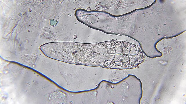 Demodex brevis mite moving legs with visible body structure under 400x bright field microscopy. 4K scientific microscopy footage.