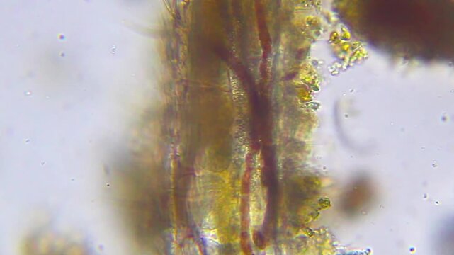 Small worm covered with bristles and spines, showing visible chitin structure and internal anatomy under 100x brightfield microscopy. Detailed 4k microscopic view